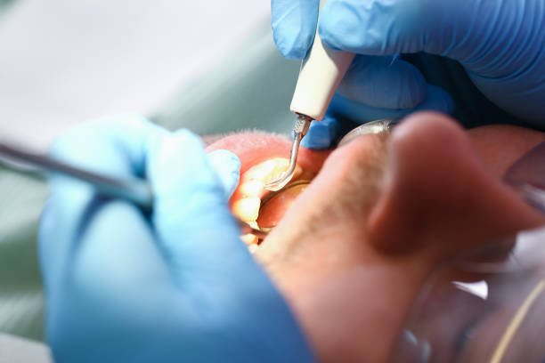 Best Emergency Dental Care for Abscessed Tooth in Green Forest, AR